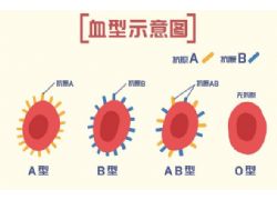 研究发现血型与疾病的发生有相关性